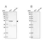 Merck Anti-SCP2 antibody produced in rabbit