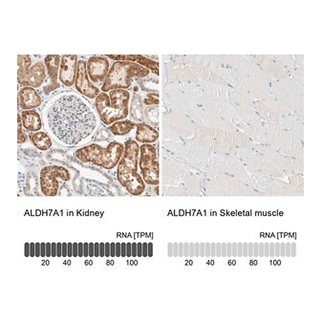 Merck Anti-ALDH7A1 antibody produced in rabbit