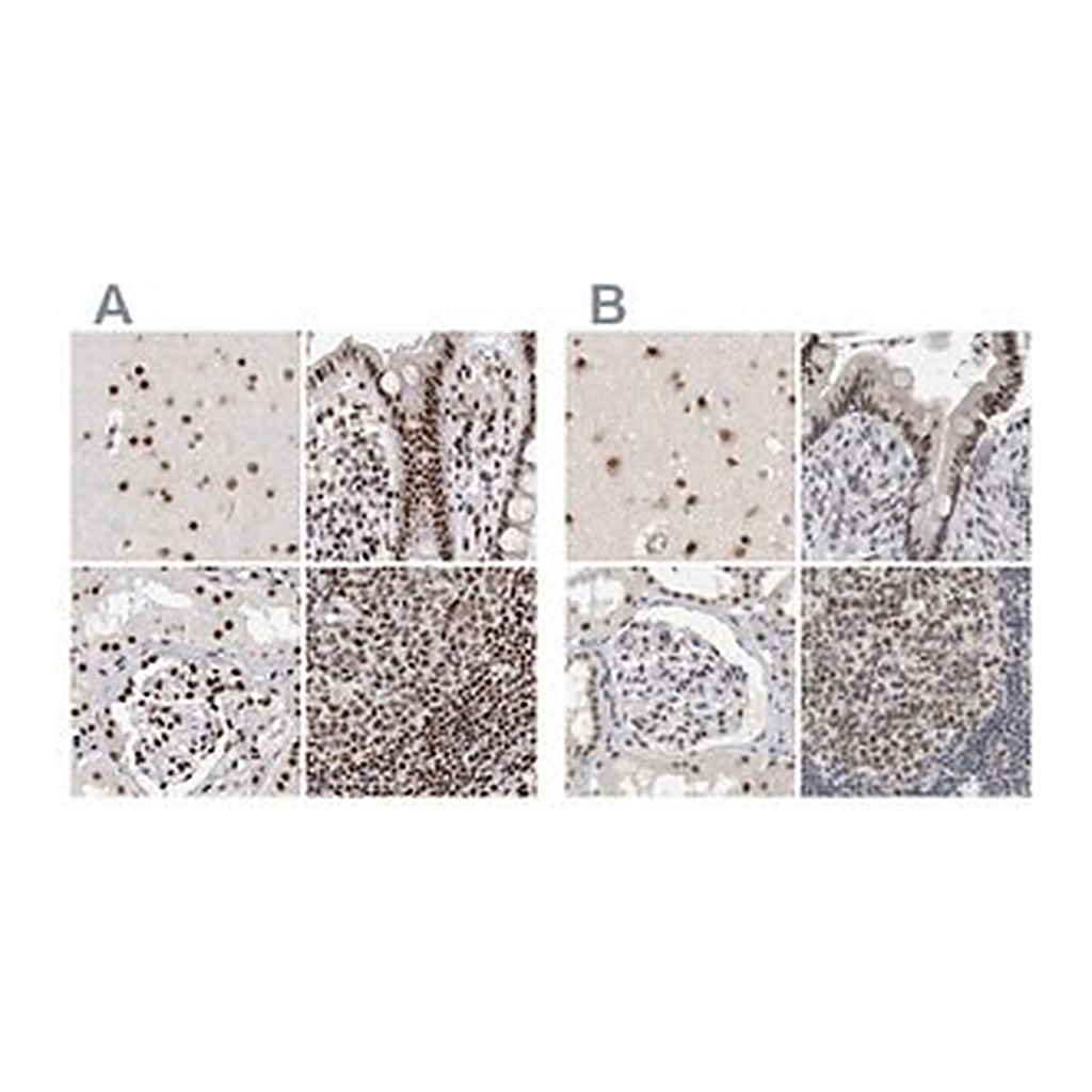 Merck Anti-RBM6 antibody produced in rabbit