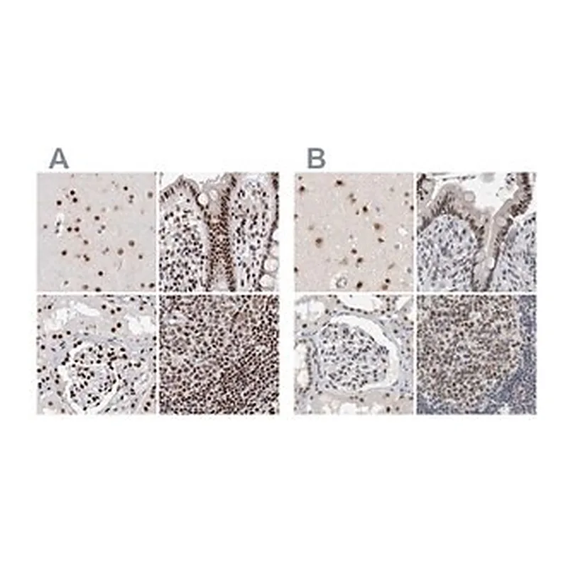 Merck Anti-RBM6 antibody produced in rabbit