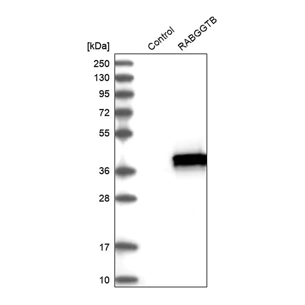 Merck Anti-RABGGTB antibody produced in rabbit