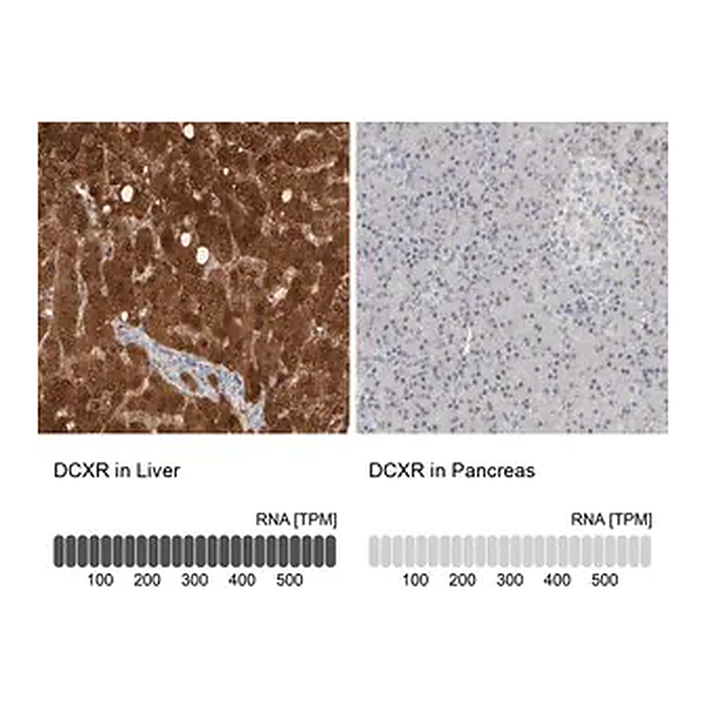 Merck Anti-DCXR antibody produced in rabbit