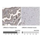 Merck Anti-LRRC45 antibody produced in rabbit