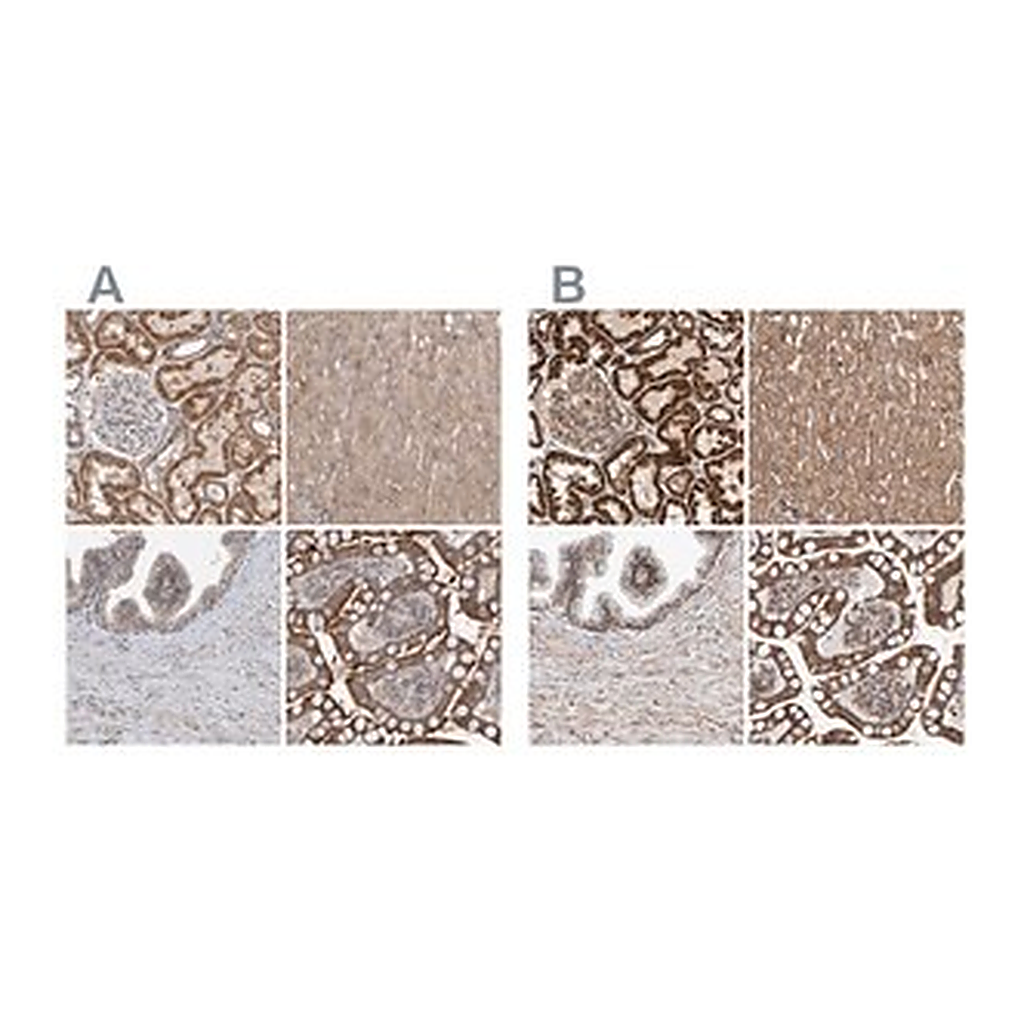Merck Anti-MRPL45 antibody produced in rabbit