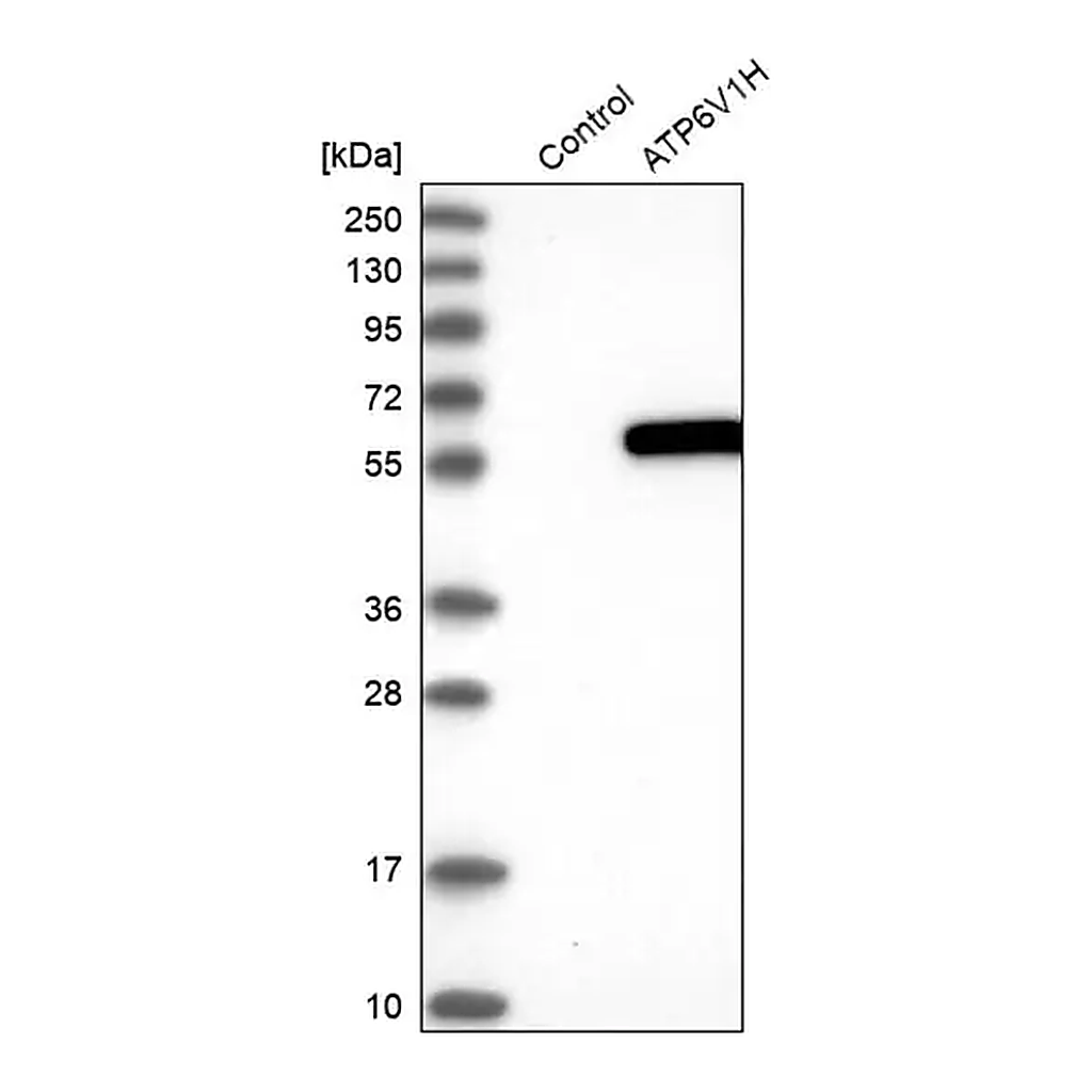 Merck Anti-ATP6V1H antibody produced in rabbit
