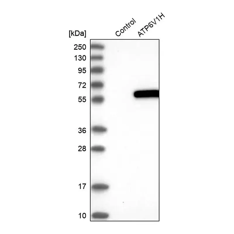 Merck Anti-ATP6V1H antibody produced in rabbit