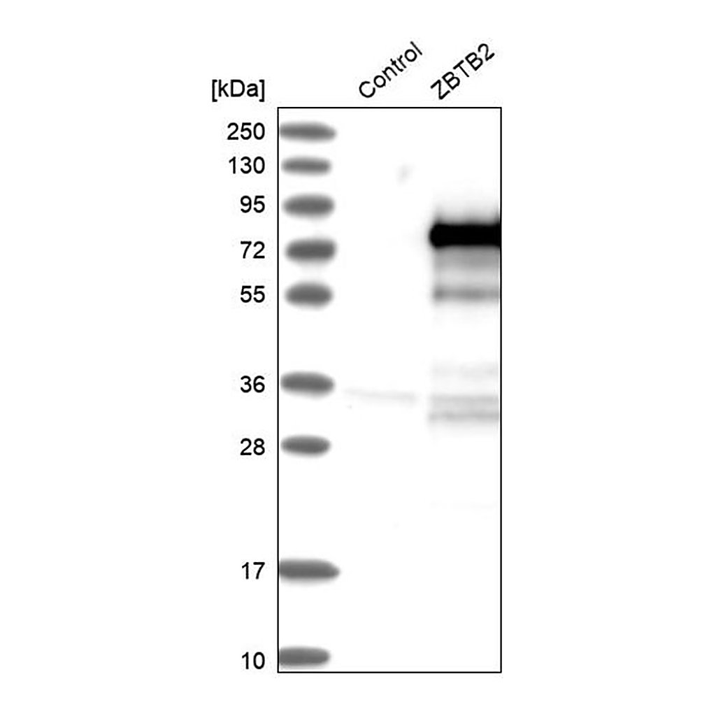 Merck Anti-ZBTB2 antibody produced in rabbit