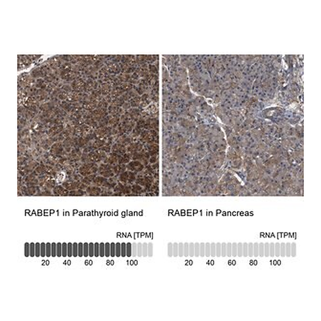 Merck Anti-RABEP1 antibody produced in rabbit