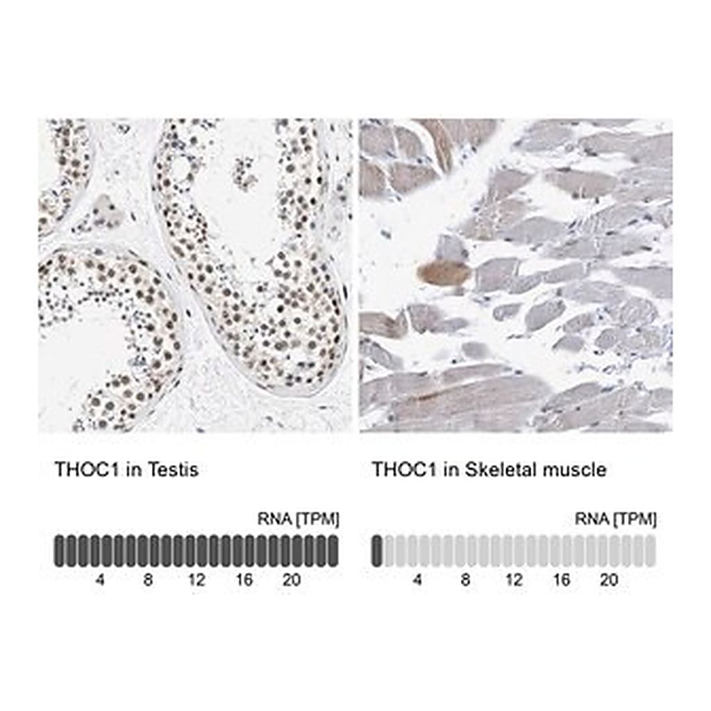 Merck Anti-THOC1 antibody produced in rabbit