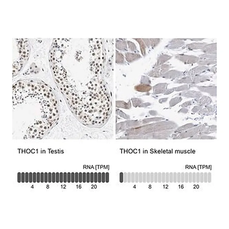 Merck Anti-THOC1 antibody produced in rabbit
