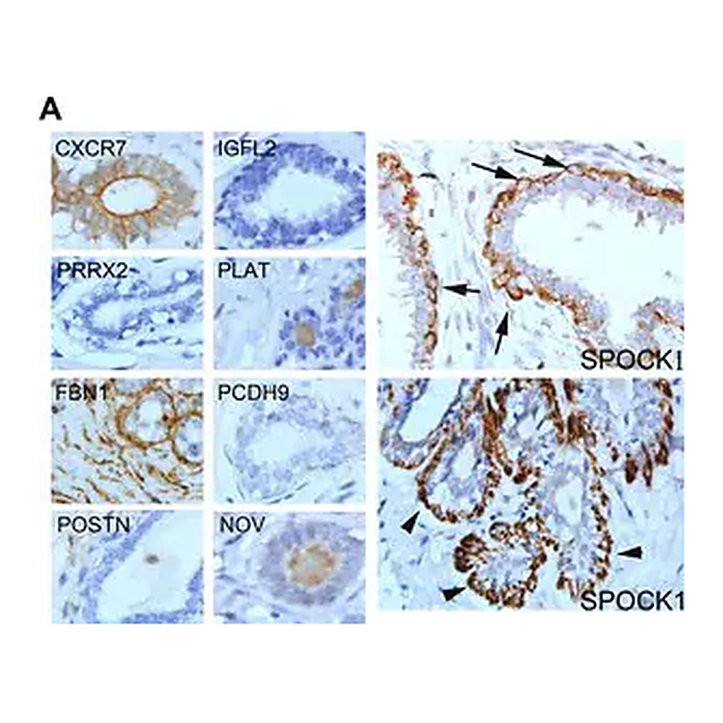 Merck Anti-NOV antibody produced in rabbit