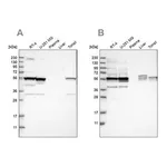 Merck Anti-SMU1 antibody produced in rabbit