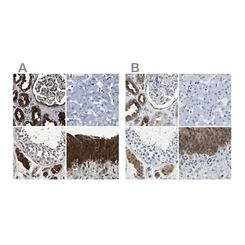 Merck Anti-GSTP1 antibody produced in rabbit
