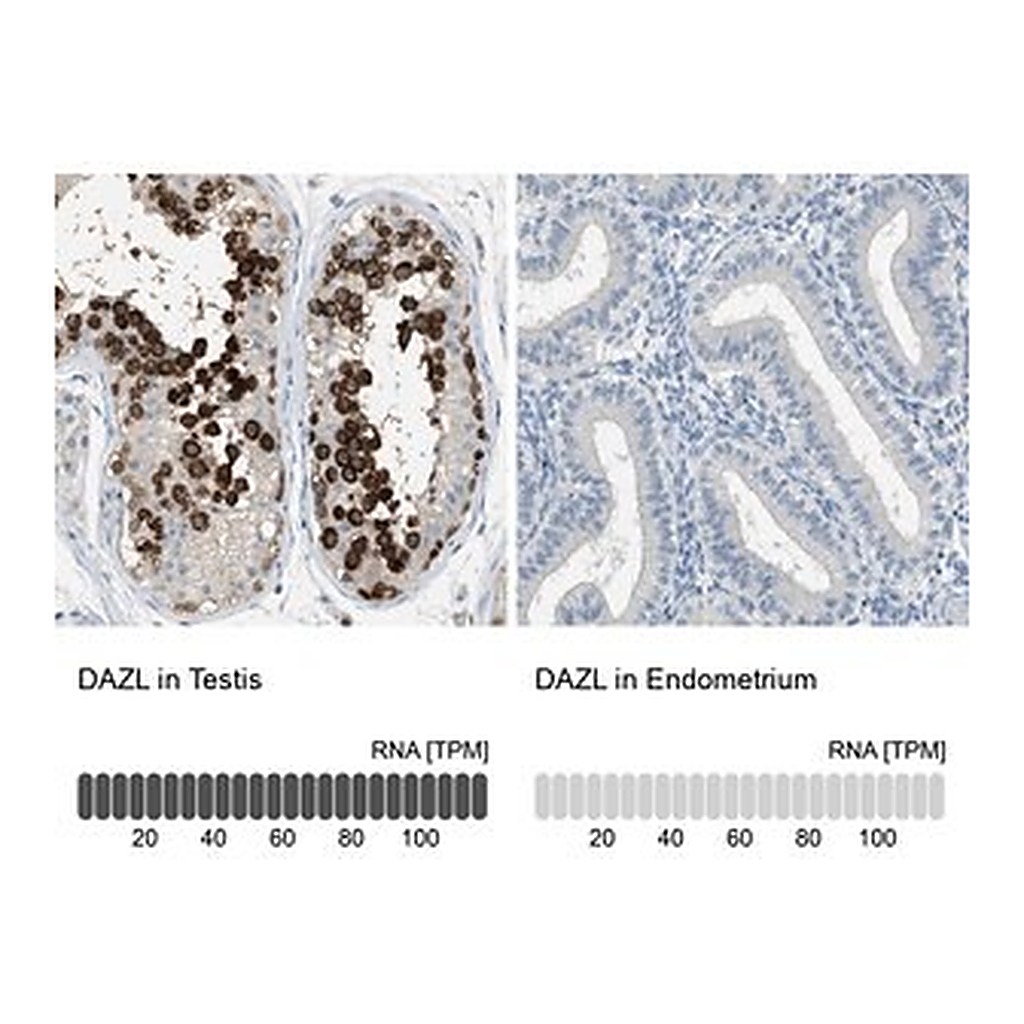 Merck Anti-DAZL antibody produced in rabbit