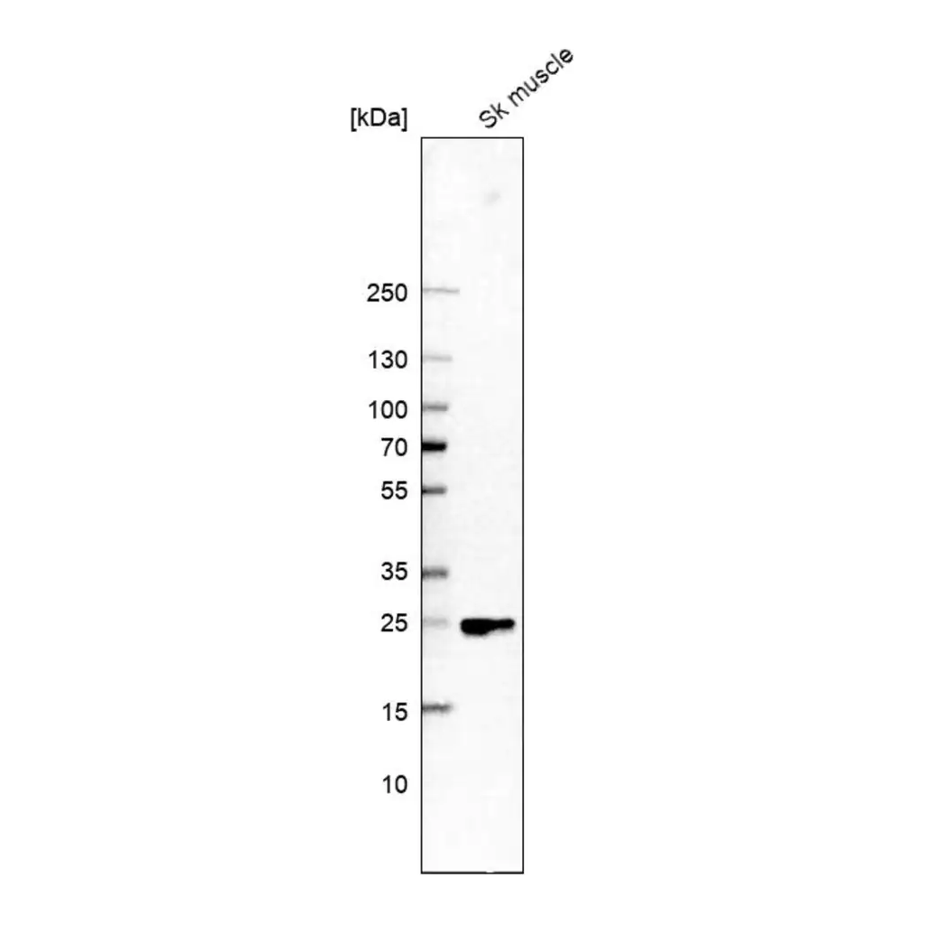Merck Anti-FITM1 antibody produced in rabbit