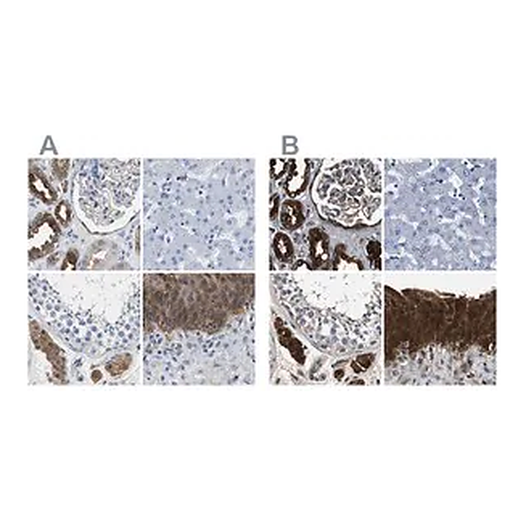 Merck Anti-GSTP1 antibody produced in rabbit
