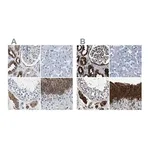 Merck Anti-GSTP1 antibody produced in rabbit