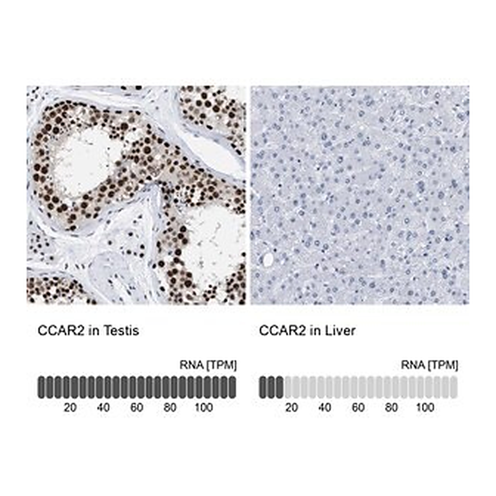 Merck Anti-CCAR2 antibody produced in rabbit