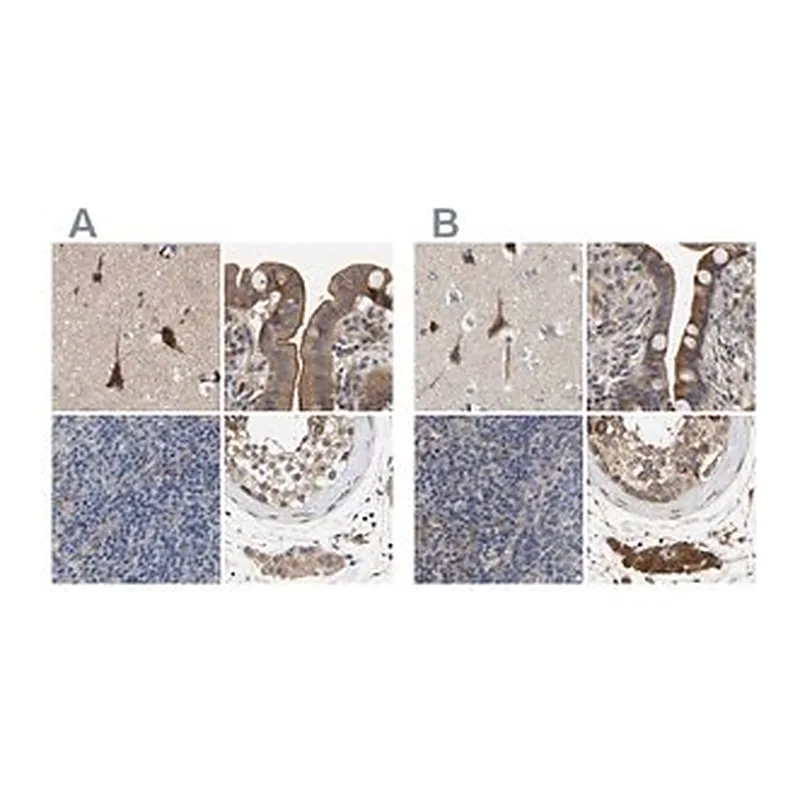 Merck Anti-CCDC155 antibody produced in rabbit