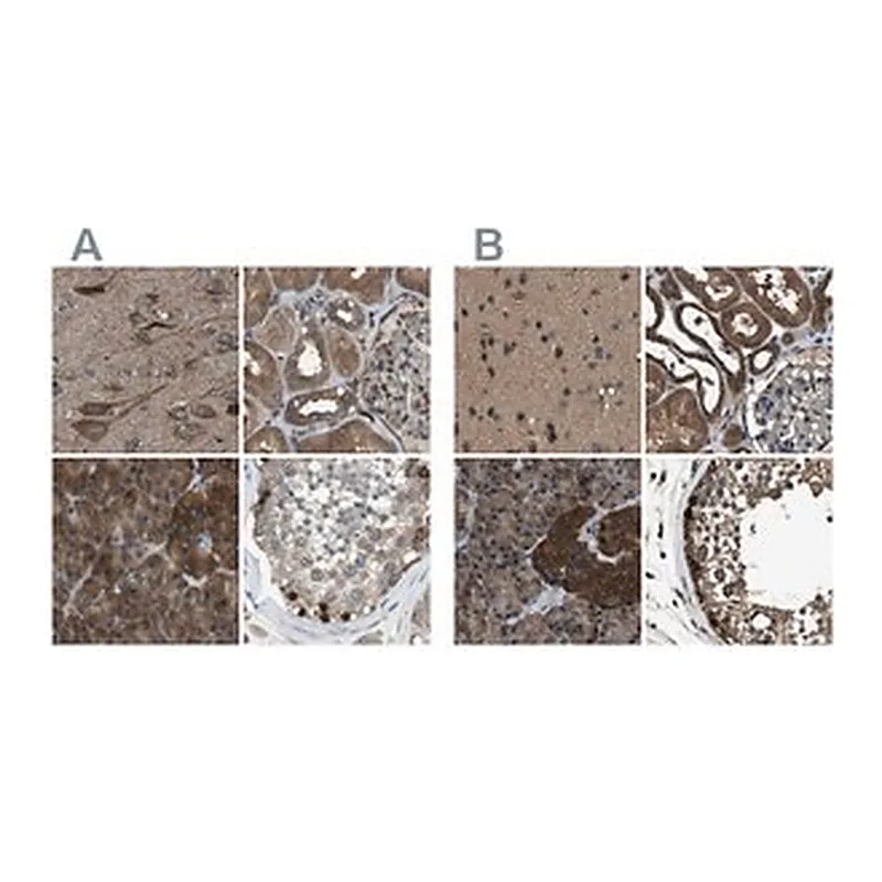 Merck Anti-ARFGAP2 antibody produced in rabbit