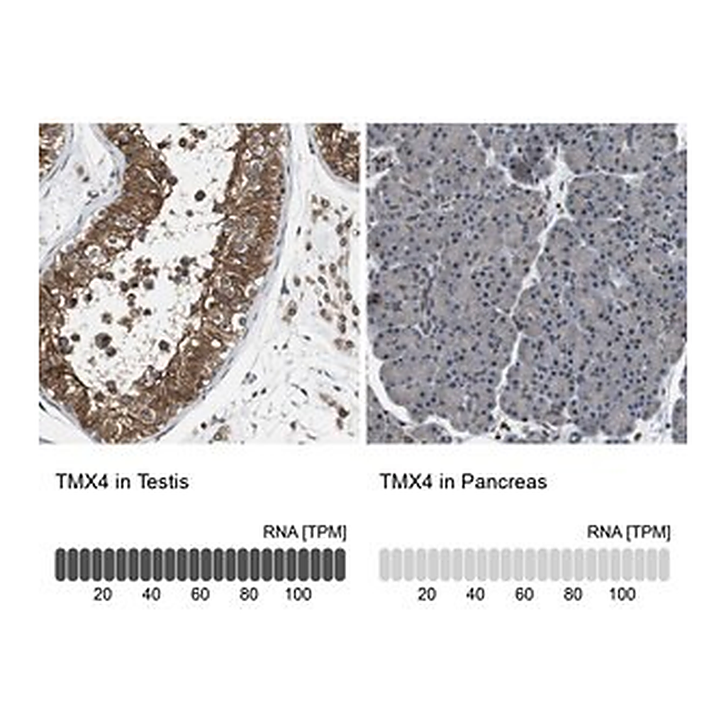 Merck Anti-TMX4 antibody produced in rabbit