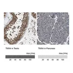 Merck Anti-TMX4 antibody produced in rabbit