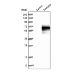 Merck Anti-MAP3K8 antibody produced in rabbit