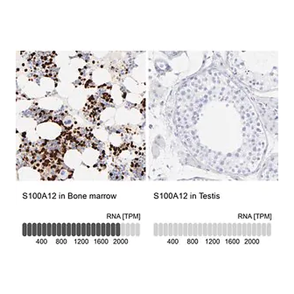 Merck Anti-S100A12 antibody produced in rabbit