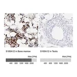 Merck Anti-S100A12 antibody produced in rabbit