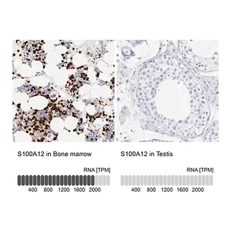 Merck Anti-S100A12 antibody produced in rabbit