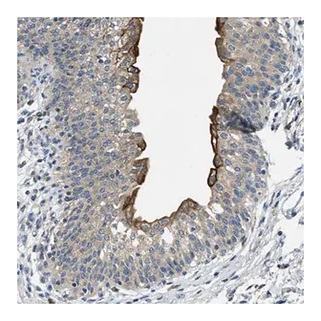 Merck Anti-RIPK2 antibody produced in rabbit