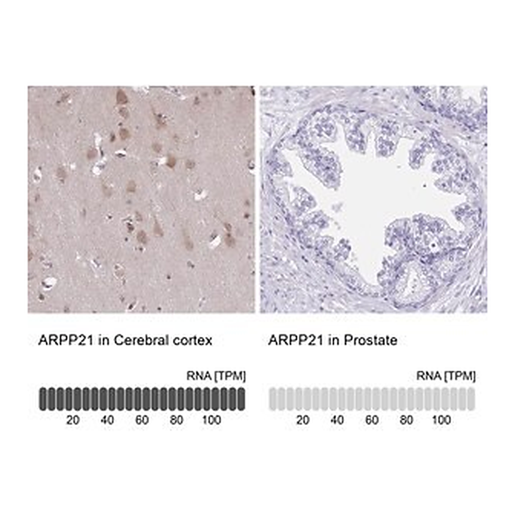 Merck ANTI-ARPP21 antibody produced in rabbit