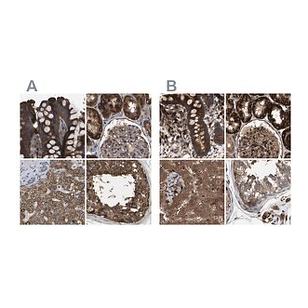 Merck Anti-GCC1 antibody produced in rabbit