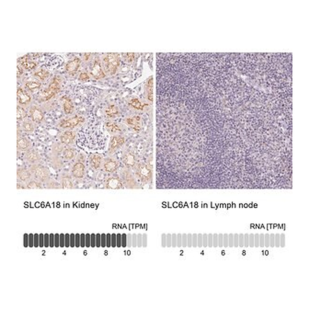 Merck Anti-SLC6A18 antibody produced in rabbit