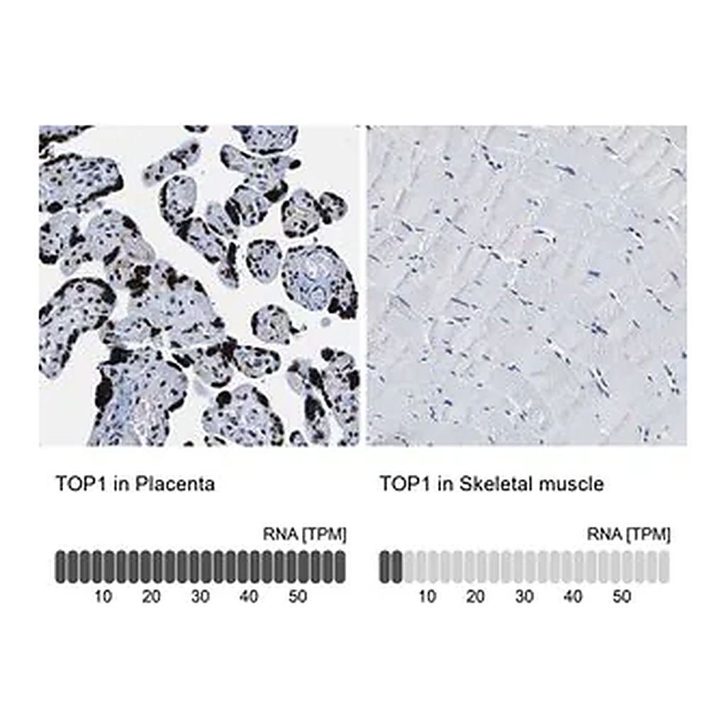 Merck Anti-TOP1 antibody produced in rabbit