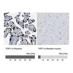 Merck Anti-TOP1 antibody produced in rabbit