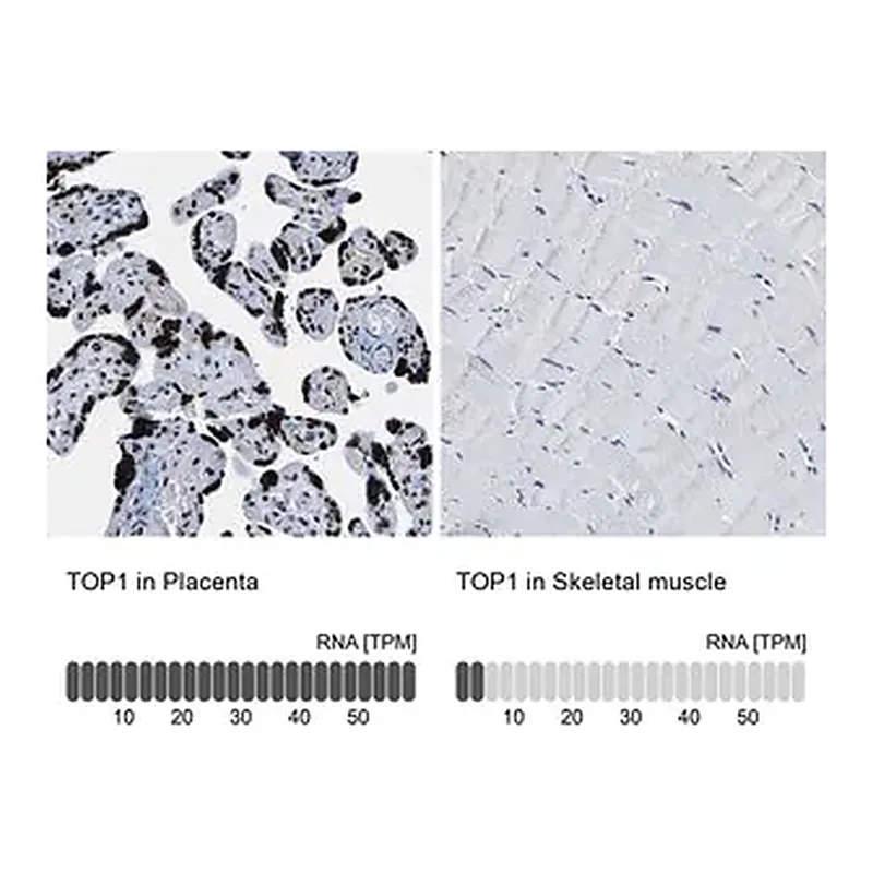 Merck Anti-TOP1 antibody produced in rabbit