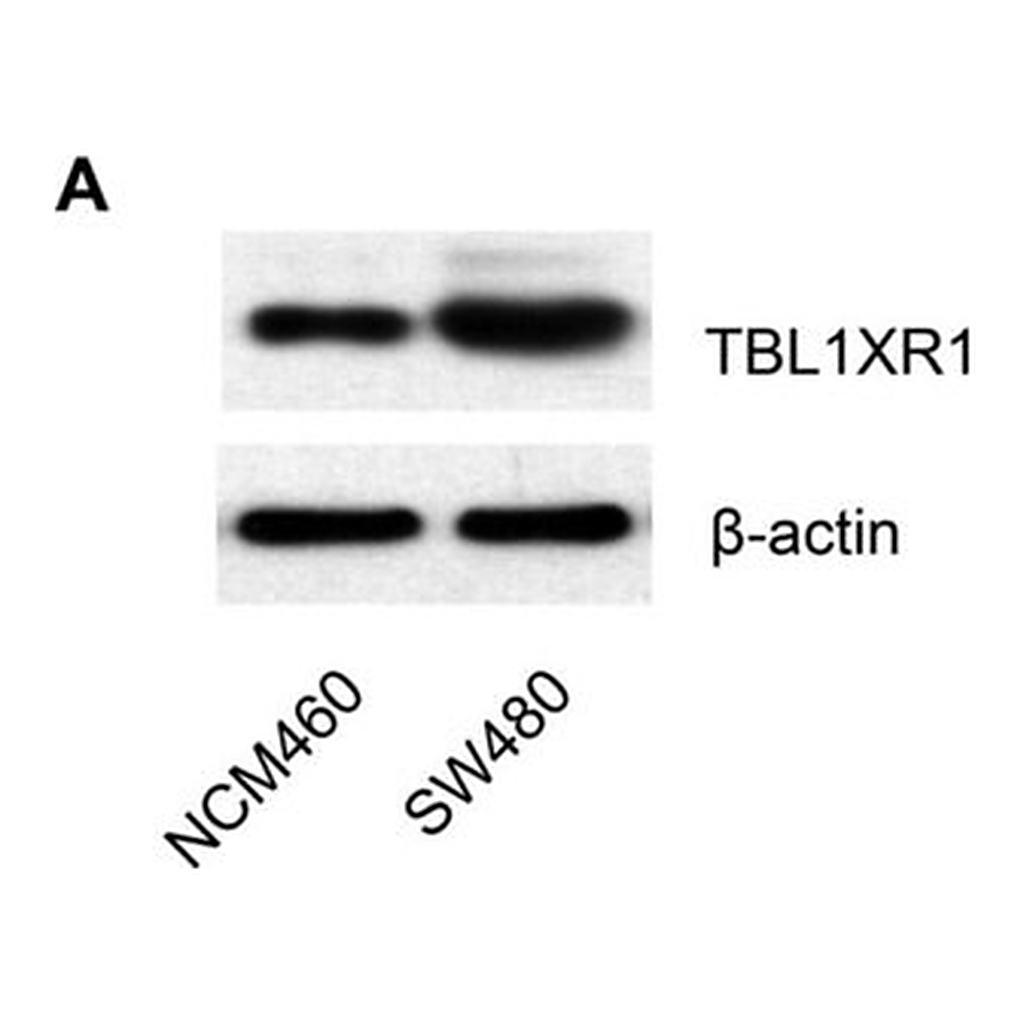 Merck Anti-TBL1XR1 antibody produced in rabbit