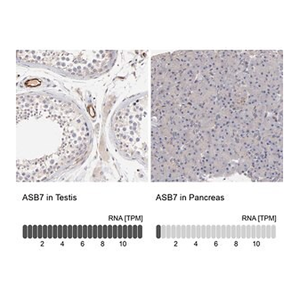 Merck Anti-ASB7 antibody produced in rabbit