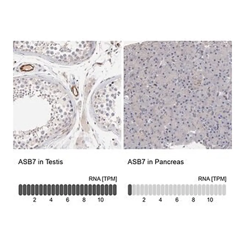 Merck Anti-ASB7 antibody produced in rabbit