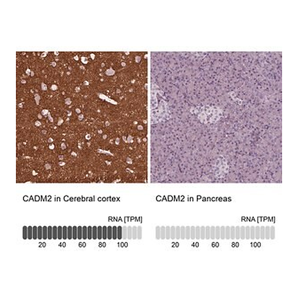 Merck Anti-CADM2 antibody produced in rabbit