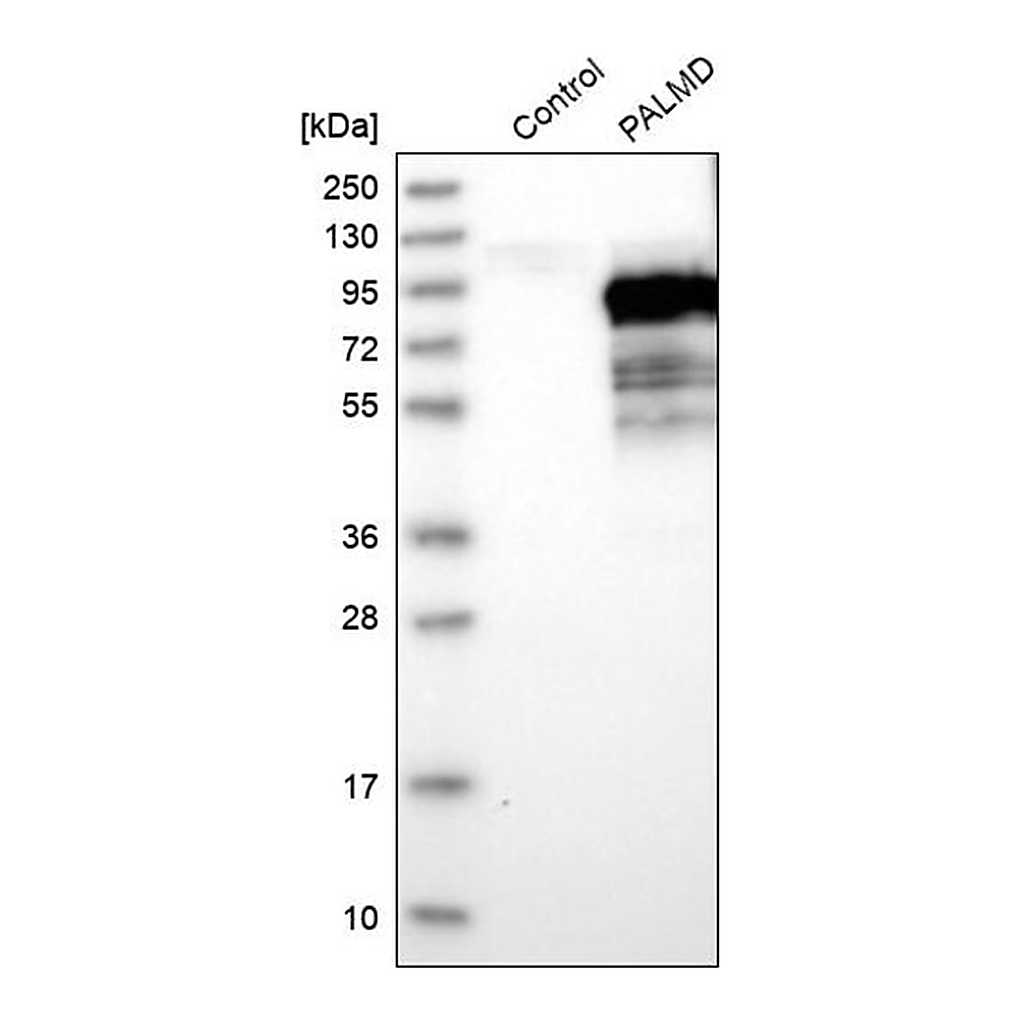 Merck Anti-PALMD antibody produced in rabbit