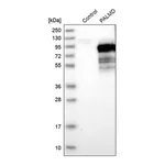 Merck Anti-PALMD antibody produced in rabbit