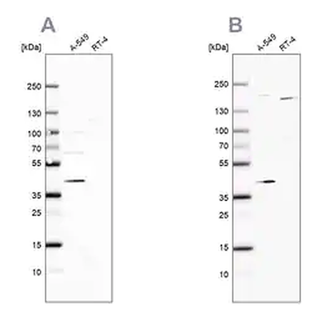 Merck Anti-GALK1 antibody produced in rabbit