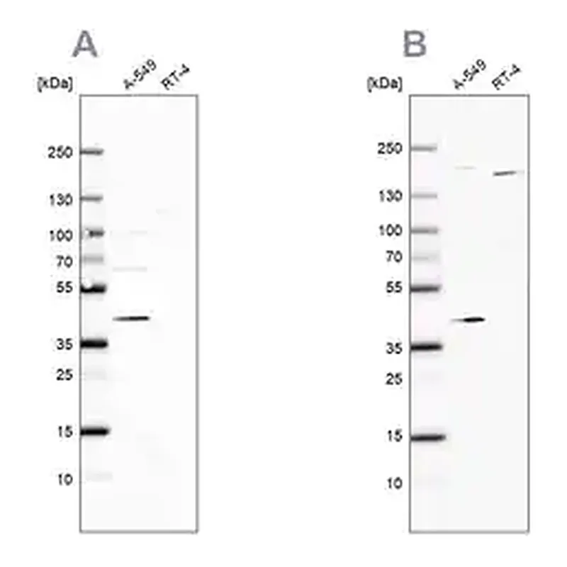Merck Anti-GALK1 antibody produced in rabbit