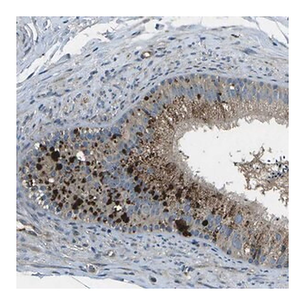 Merck Anti-PXYLP1 antibody produced in rabbit