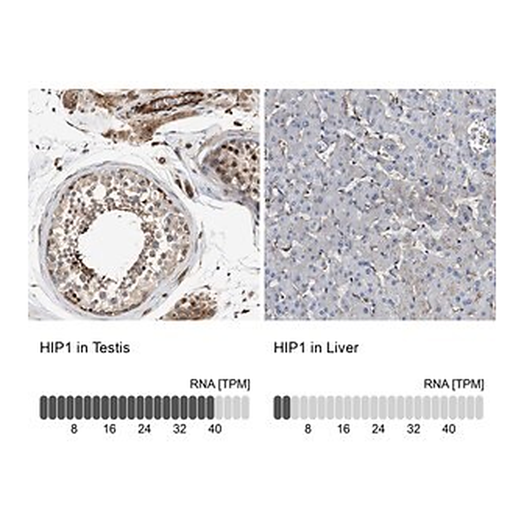 Merck Anti-HIP1 antibody produced in rabbit