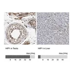 Merck Anti-HIP1 antibody produced in rabbit
