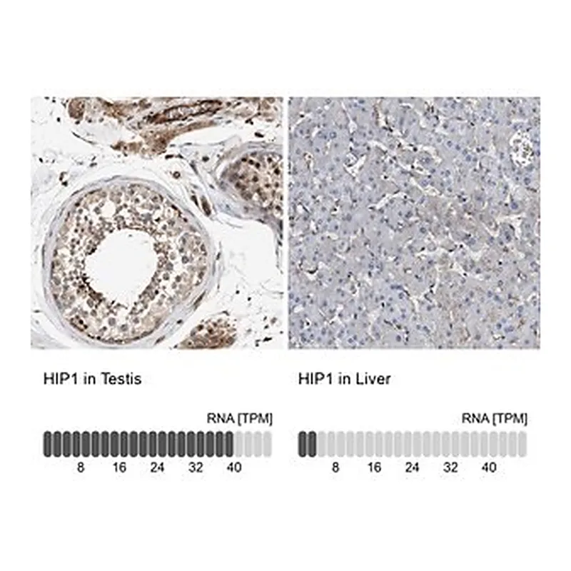 Merck Anti-HIP1 antibody produced in rabbit