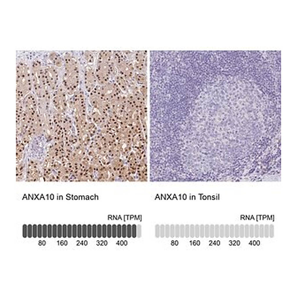 Merck Anti-ANXA10 antibody produced in rabbit